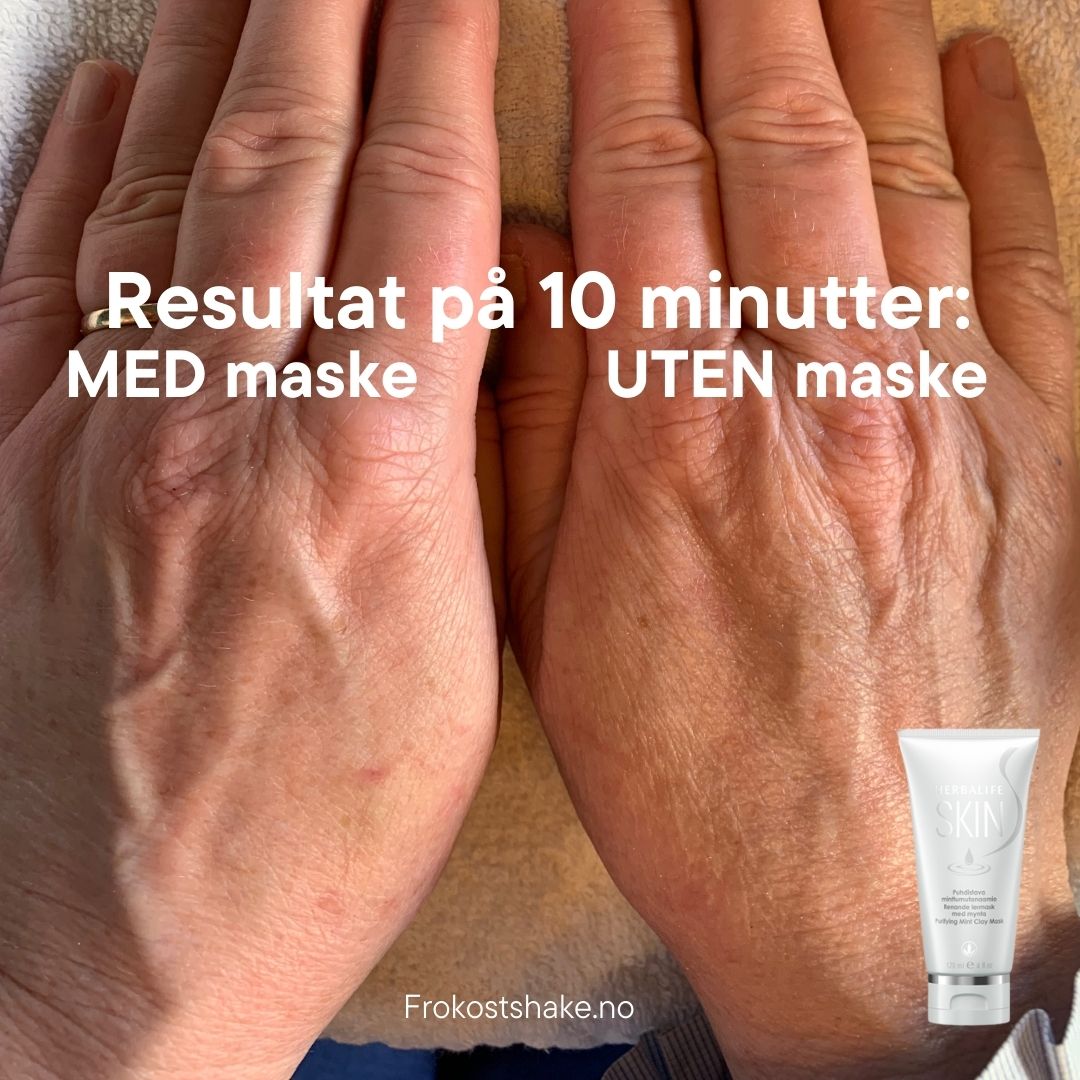 To hender på et håndkle og teksten "Resultat på 10 minutter, med maske, uten maske" og bilde av en tube Herbalife SKIN Purifying Mint Clay Mask ansiktsmaske.
